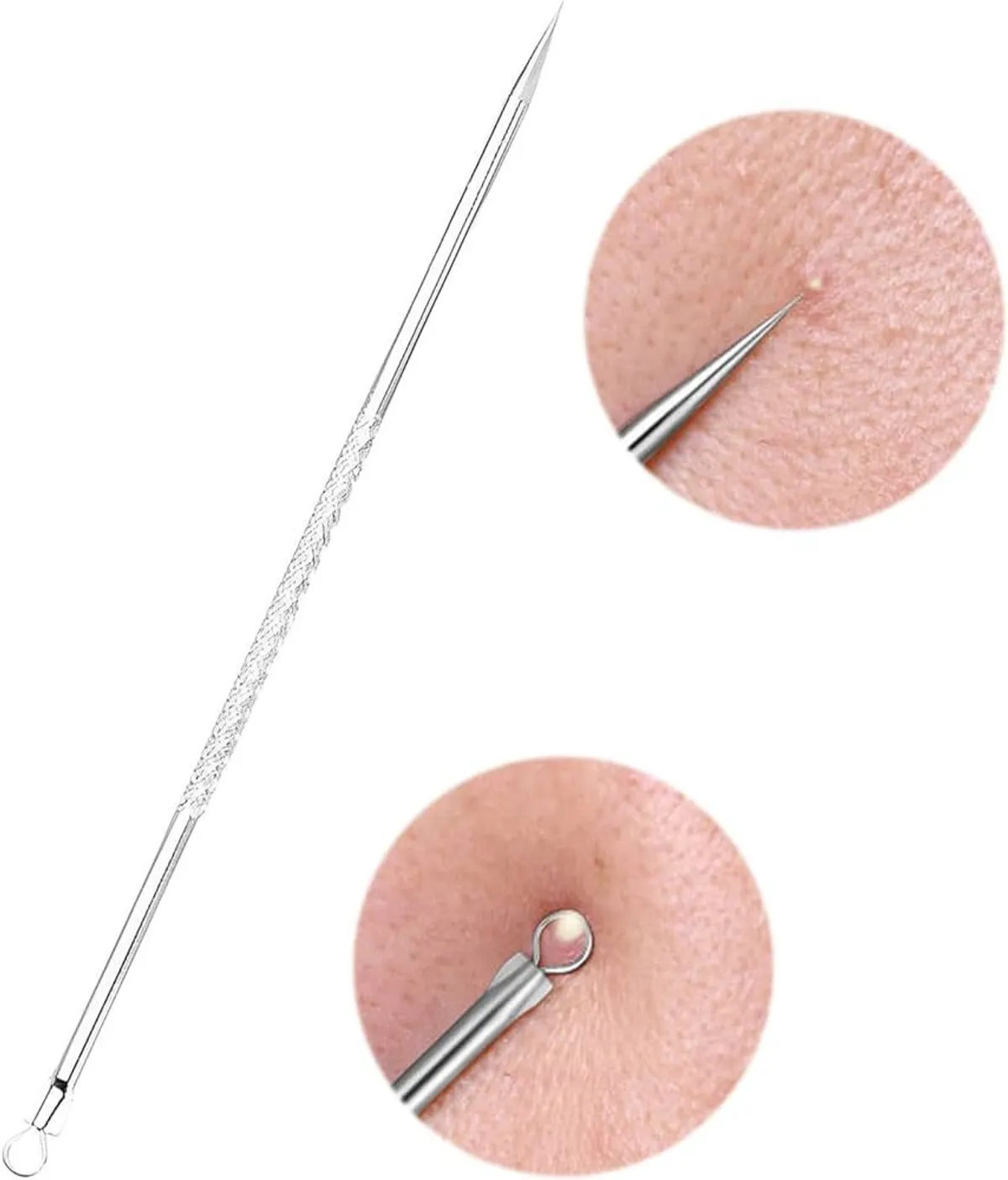 Stainless Steel Acne Blackhead Removal Tool - 1pc