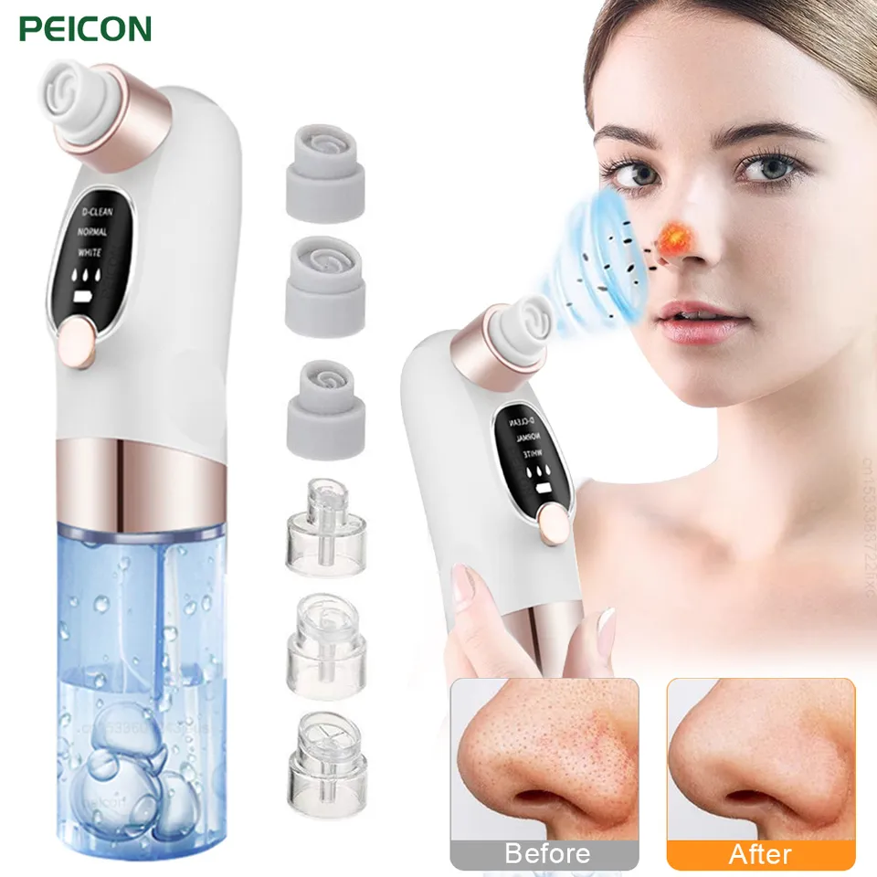 Water-Based Electric Facial Pore Cleaner - Dual Tank Blackhead Remover