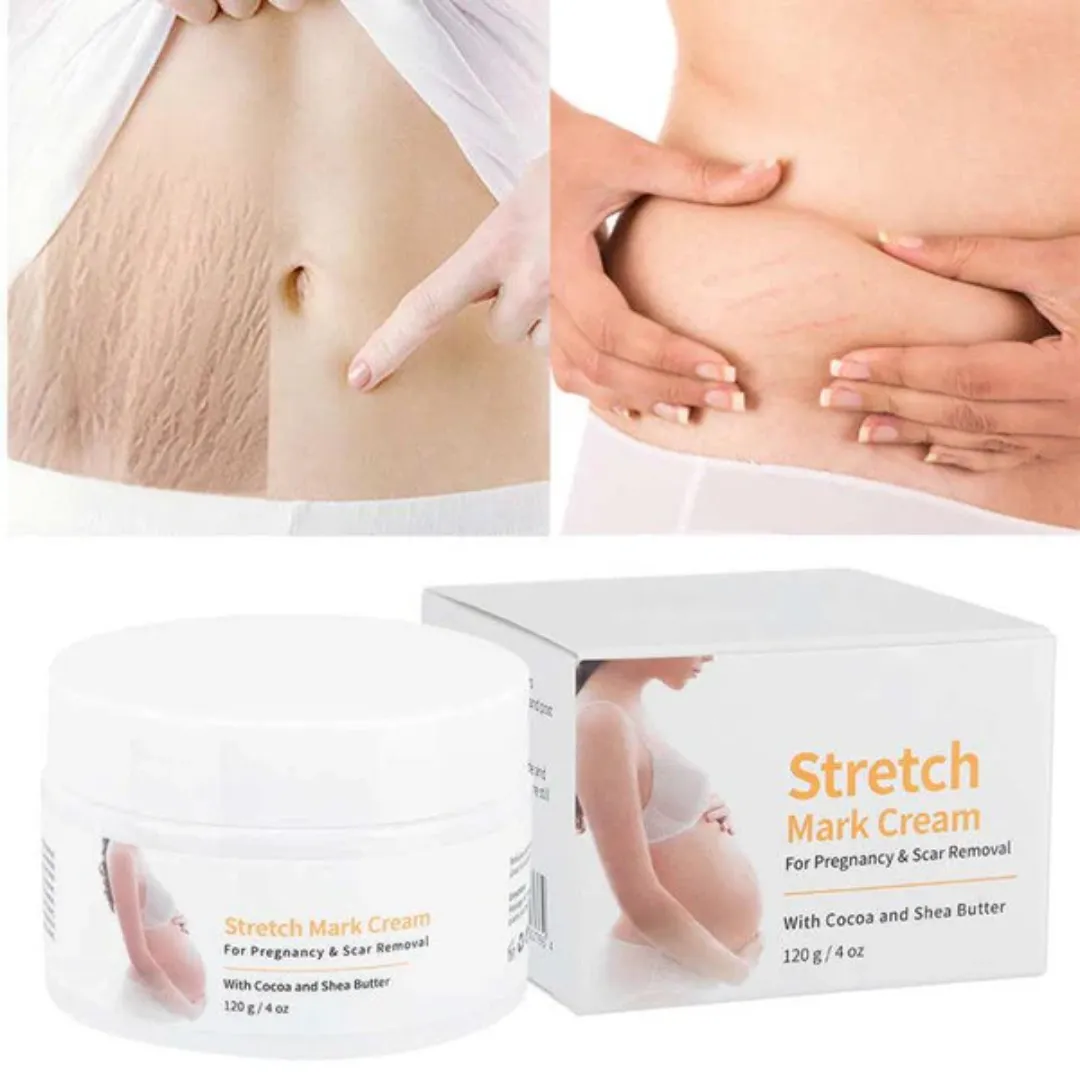 Melao Stretch Mark Cream:-120 gm